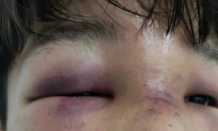 Phụ huynh hành hung bạn của con chỉ vì mâu thuẫn giữa con với bạn cùng lớp