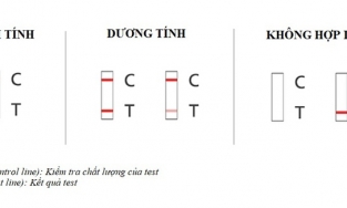 Cách tự test nhanh Covid tại nhà: 7 bước cơ bản dễ dàng, chính xác, không đau