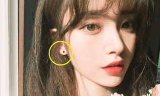 Có nốt ruồi ở  vị trí này là người giàu sang, trung vận cực vượng đừng dại tẩy đi