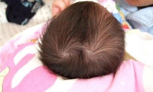 Nhìn xoáy trên đầu đoán vận mệnh: Dáng xoáy thông minh, giàu có