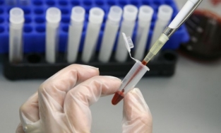 Lần đầu tiên trên thế giới có người khỏi HIV nhờ liệu pháp cấy tế bào gốc