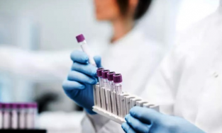 Giáo sư Đại học Mỹ cho biết xét nghiệm nước bọt có khả năng phát hiện Omicron hiệu quả hơn chọc mũi