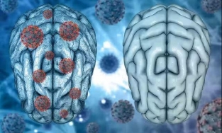 Nguyên GĐ BV Nhiệt đới TW: Covid-19 để lại 203 di chứng, 52% người gặp vấn đề về trí nhớ 