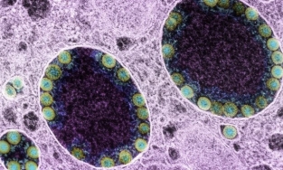 Xuất hiện biến thể mới XE có khả năng lây lan cao hơn tới 43% so với Omicron