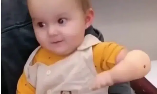 Biểu cảm đáng yêu của bé gái khi lần đầu tiên được ghép cánh tay giả