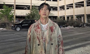 Yong Hwa (CNBLUE) đăng ảnh người bê bết máu me, còn cảm ơn khán giả