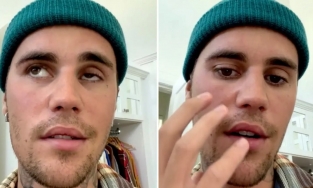Justin Bieber hủy mọi show diễn vì bị liệt nửa mặt do nhiễm virus hiếm