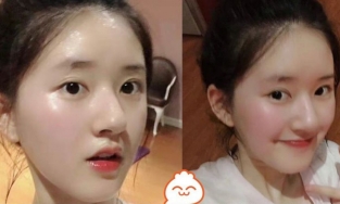 Triệu Lộ Tư lên sóng MXH vì ảnh chụp bằng cam thường năm 18 tuổi: Mũi cao, da mịn như em bé