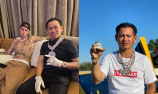 Johnny Đặng làm ngay bộ răng 30 tỷ cho Justin Bieber để thu hồi vốn