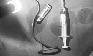 Hà Nội: Thanh niên mắc kẹt cục pin trong hậu môn vì 'tự nhét'