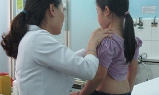 Bé gái 6 tuổi ở Hà Nội mắc chứng dậy thì sớm