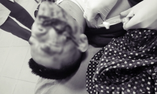 Nghệ An: Nghịch pháo, 2 anh em bị nát tay, hỏng mặt