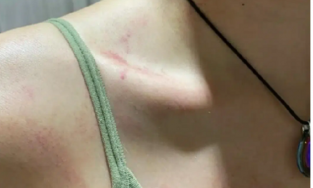 NTK Ruby Trần tố bạn trai cũ là HLV bơi bạo hành, quỵt tiền