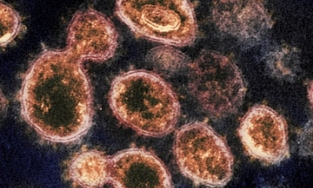 Ghi nhận người đầu tiên nhiễm hai biến thể Covid-19 cùng lúc