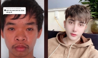 Chàng trai Hưng Yên dùng ảnh tội phạm để khoe chiếc tích thẩm mỹ?