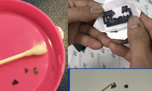 Long An: Bé gái 15 tháng tuổi nguy kịch vì nuốt 7 miếng dao lam vào bụng