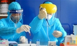 Tối 31/5: Thêm 85 ca Covid-19 mới, trong đó 82 ca trong nước