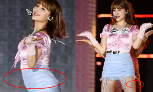 Nancy (MOMOLAND) lại trở về eo bánh mì, đôi chân bầm đen khó hiểu