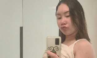 Nữ danh hài Hwang Shin Young mang thai ba, tăng 44kg, phải ngồi xe lăn 