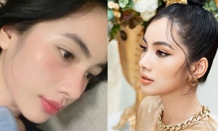 Cẩm Đan tung ảnh chứng minh nhan sắc cha mẹ cho, không liên quan đến bác sĩ