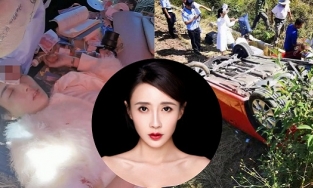 Diễn viên Lý Hy Nhi gặp tai nạn xe nghiêm trọng, nhập viện cấp cứu khâu 54 mũi