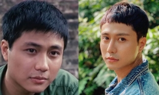 Ngoại hình Thanh Sơn 10 năm trước khác lạ ra sao mà bị nghi đến thăm bác sĩ