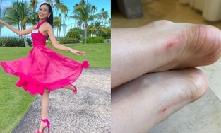 Ngày thứ ba tại Miss World, đôi chân 'quốc bảo' của Đỗ Thị Hà đã sưng tấy