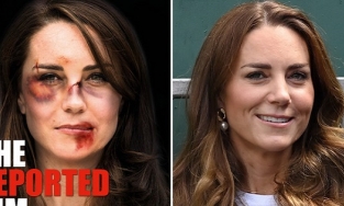  Hình ảnh Công nương Kate với gương mặt thâm đen như bị đánh gây phẫn nộ