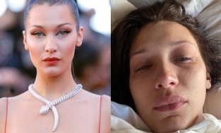 Nguyên nhân 'sốc' đằng sau việc Bella Hadid thường xuyên đăng ảnh khóc lóc lên mạng xã hội