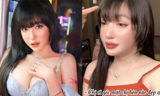 Elly Trần xuất hiện với mặt sưng, ngoại hình phát tướng khó nhận ra