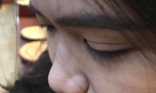 Cô gái bất ngờ bị người yêu của quản lý quán bar trên phố Tạ Hiện 'ném gạt tàn' vào đầu