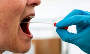 Xuất hiện triệu chứng mới khi nhiễm Covid-19: Không ở họng mà ở lưỡi