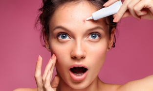 Xướng tên 4 loại kem trị mụn hữu hiệu được ưa chuộng