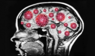 Covid-19 có thể xâm nhập vào não người