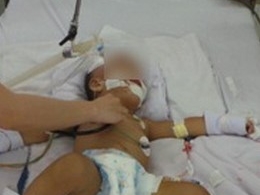 Bé trai 12 tuổi tử vong sau 7 ngày mắc bạch hầu