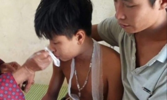 Ba học sinh nhập viện vì laptop phát nổ