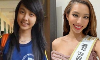 Loạt Hoa hậu, Á hậu 'lên hương' nhan sắc chỉ nhờ tân trang răng lợi