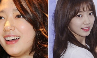 Giảm béo mặt bằng đá viên như Park Shin Hye: Mặt V-line trong tầm tay