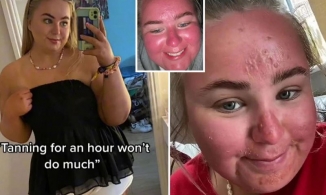 Sự thật về cô gái phơi nắng một giờ, gương mặt lập tức to lên gấp đôi