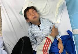 Quảng Bình: Bé trai bị cò mổ hỏng mắt