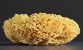 Cần Thơ: 10 viên sỏi to như san hô trong thận người đàn ông 60 tuổi