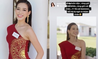 Đôi chân 1m11 của Đỗ Thị Hà bị thâm tím trong clip Miss World đăng tải