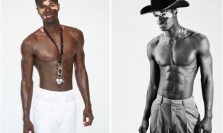 Nam người mẫu hiếm hoi có da mặt bạch biến được các nhãn hàng săn đón