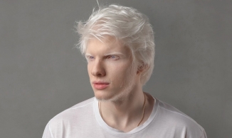 5 người mẫu với vẻ đẹp vượt chuẩn mực, truyền cảm hứng