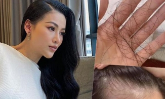 Cách trị rụng tóc của H'Hen Niê, Phương Khánh và các Hoa hậu, Á hậu Việt