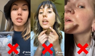 Chuyên gia khuyên bạn không nên thử trị mụn theo 5 cách này trên TikTok