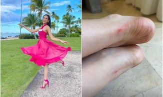 Đỗ Thị Hà mang giày cao gót phồng rộp cả chân là do cô chưa biết đến những mẹo này