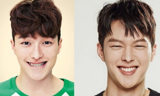 Tình trẻ của Song Hye Kyo - Jang Ki Yong và dàn mỹ nam Hàn 'lột xác' ngoạn mục nhờ niềng răng