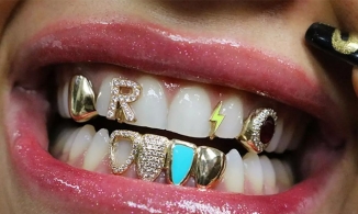 Nụ cười với 'một mồm' trang sức: Xu hướng mới được các Hiphop-er ưa chuộng