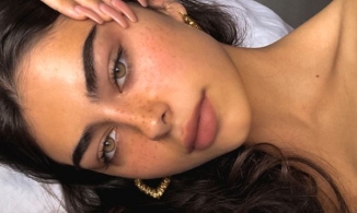 Phẫu thuật nhấn mí mắt: Ưu và nhược điểm bạn cần biết